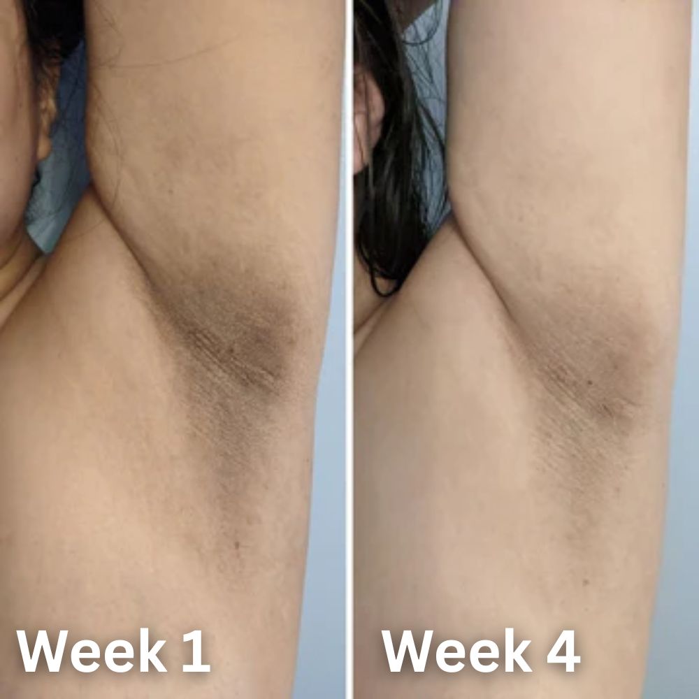Neanes® Skin Brightening Deodorant