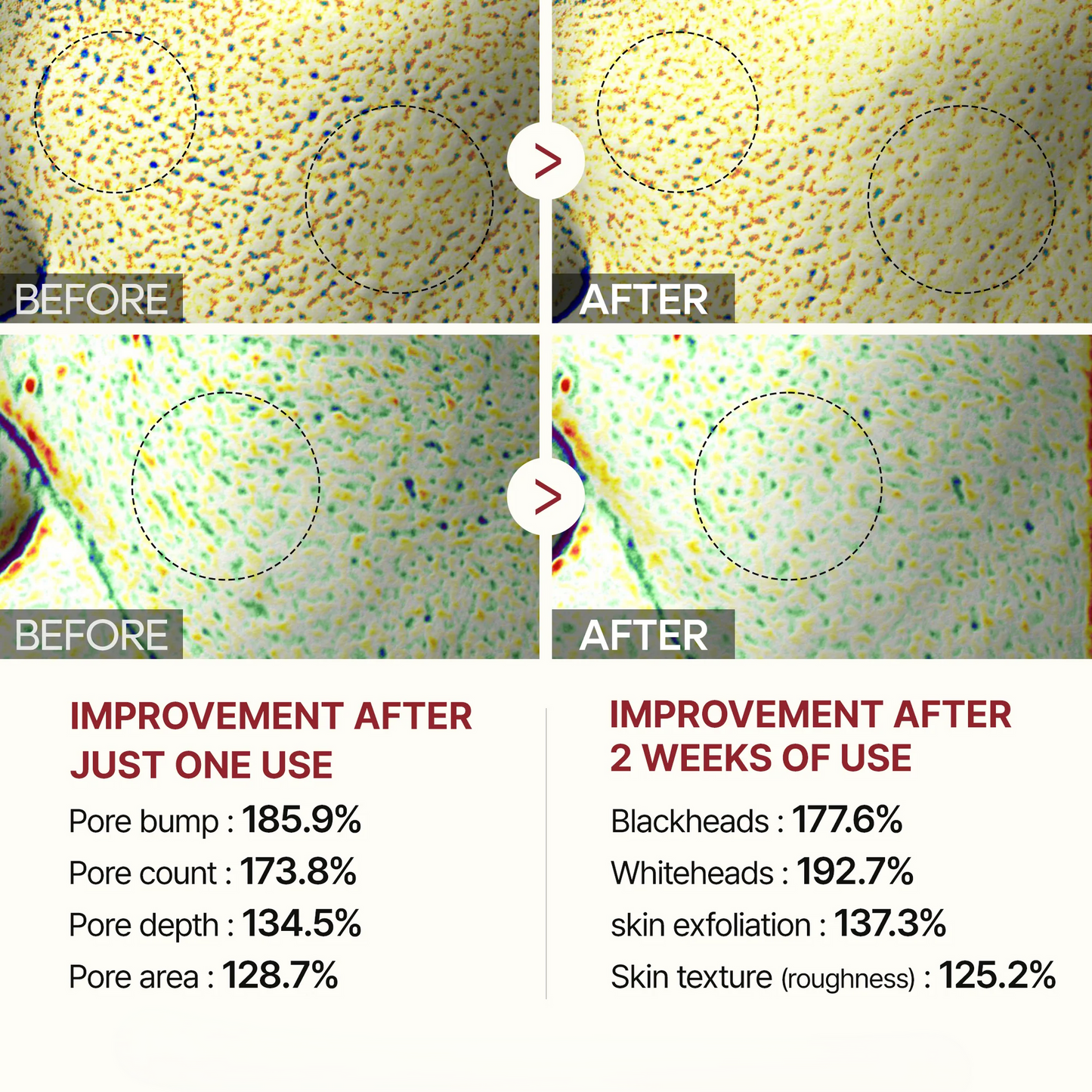 Neanes® White & Black Rice Renewal Duo