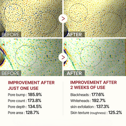 Neanes® White & Black Rice Renewal Duo