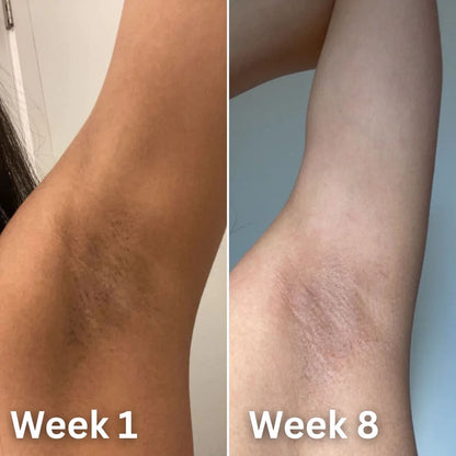 Neanes® Skin Brightening Deodorant